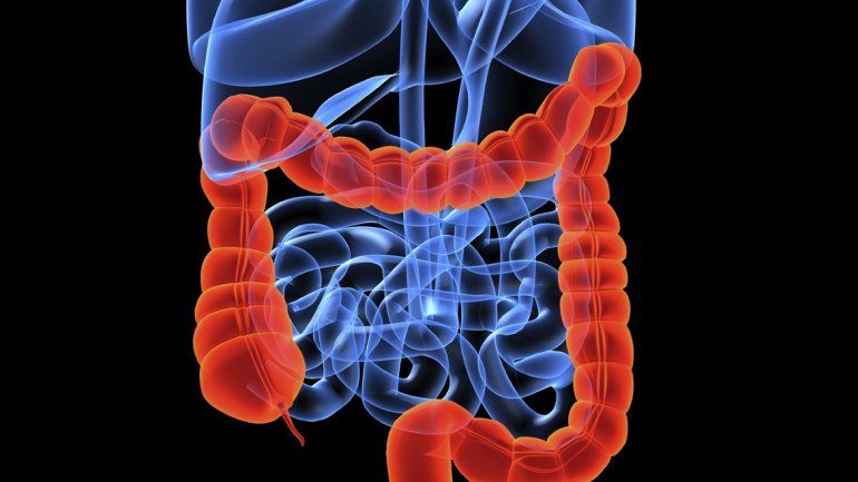 Los tipos de cáncer que más afectan  a los argentinos