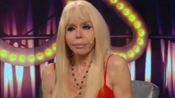 adriana aguirre dio detalles escalofriantes del accidente que sufrio adriana aguirre dio detalles escalofriantes del accidente que sufrio