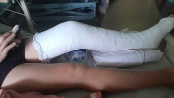 indignante: atropello a menor y lo dejo tirado en el hospital indignante: atropello a menor y lo dejo tirado en el hospital