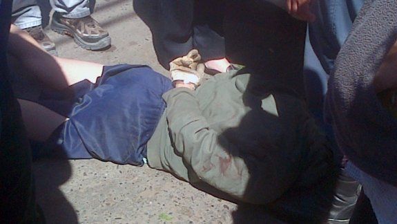 Tiroteo en un asalto a una joyería del Bajo dejó heridos 