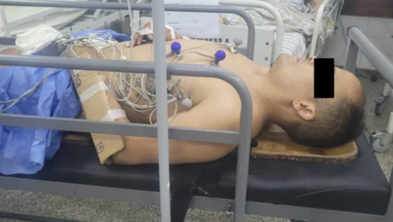 El delicuente se encuentra internado bajo custodia policial.