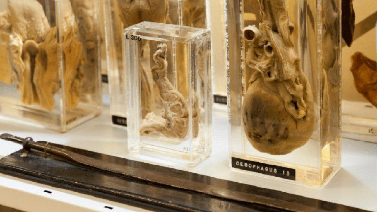 Una vasta colección de órganos con enfermedades y curiosidades.