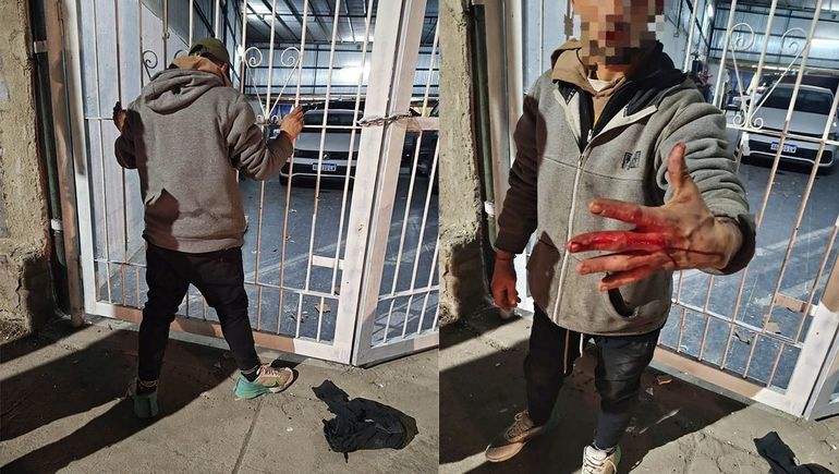 El hombre detenido por el intento de robo de una camioneta. En la maniobra se lastimó una mano. El hombre detenido por el intento de robo de una camioneta. En la maniobra se lastimó una mano.