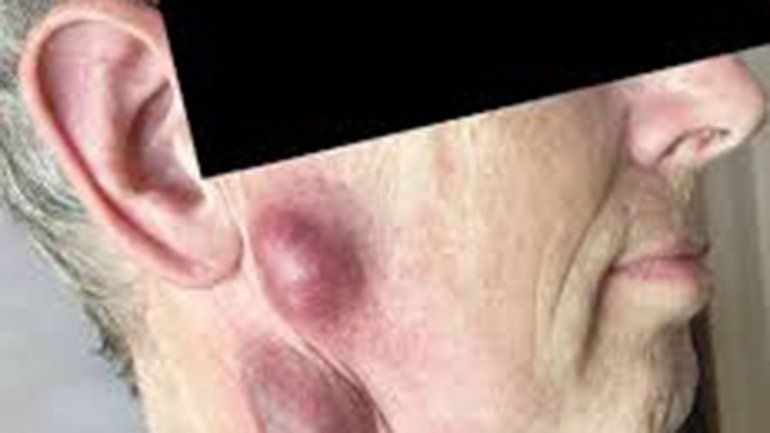 Su gato le contagió una enfermedad rara antes de morirse