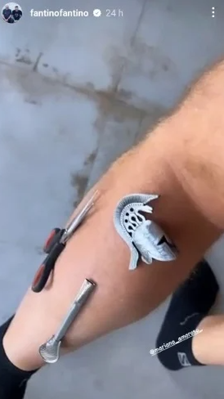 El conductor compartió por Instagram el extraño efecto de su tratamiento.